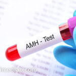 مقدار نرمال amh برای بارداری