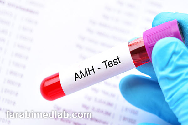 normal-amh-levels-for-pregnancy-farabimedlab.com مقدار نرمال amh برای بارداری