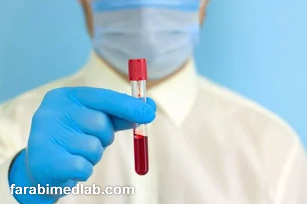 مزایای انجام آزمایش خون ازدواج در آزمایشگاه فارابی