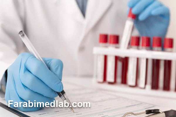 بررسی علائم هورمونی و تیروئید در آزمایش خون