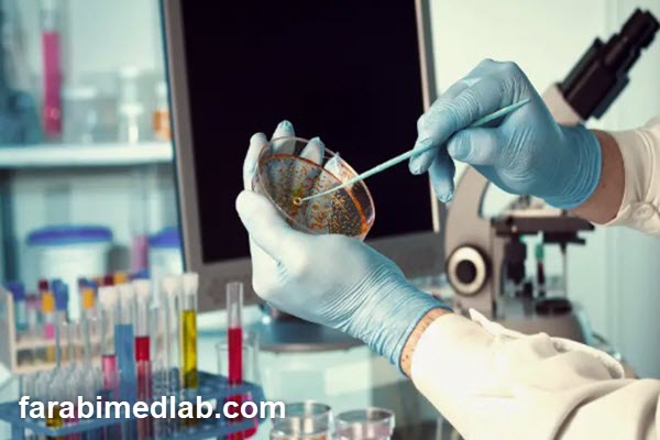 نحوه تفسیر نتایج آزمایش Anti Scl 70