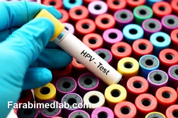 درک علمی تست HPV | شمال تهران