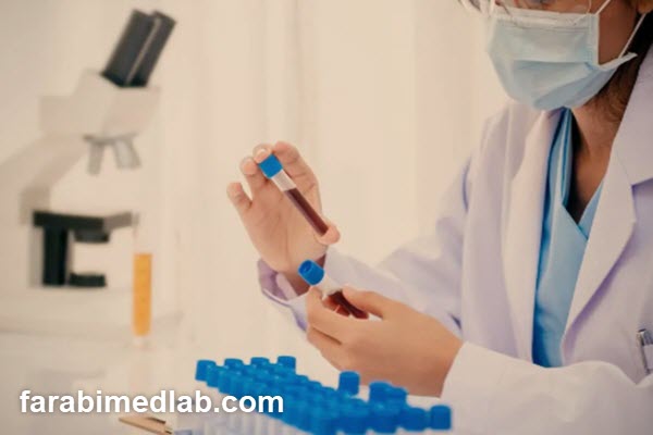 نکات مهم قبل از انجام آزمایش خون