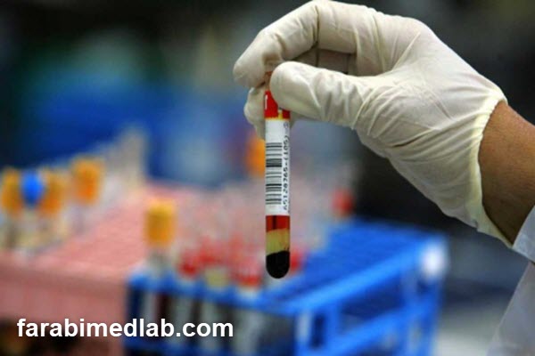 بررسی علل پایین بودن سطح EPO در خون