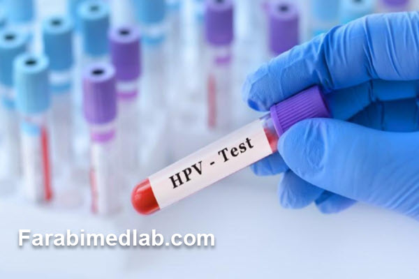 ملاحظات بالینی و اهمیت تست HPV