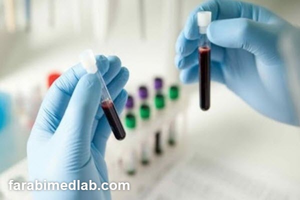 anti-scl-70-test-interpretation-farabimedlab.com تفسیر آزمایش anti scl 70