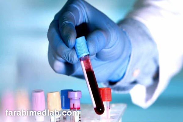 performing-a-marriage-blood-test-at-farabi-laboratory-farabimedlab.com انجام آزمایش خون ازدواج در آزمایشگاه فارابی