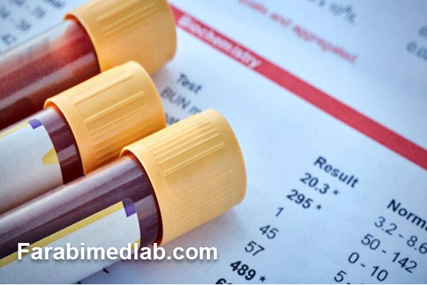 بررسی علائم اختصاری آزمایش خون