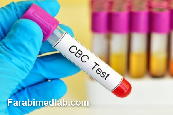 آزمایش CBC چیست؟