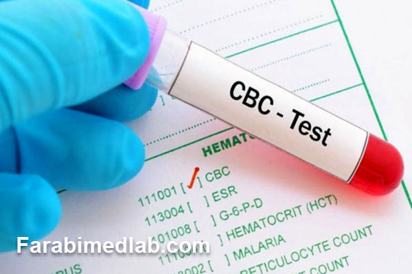 آزمایش-CBC-چیست-و-هر-کدام-از-اعداد-آن-چه-معنایی-دارند؟ آزمایش CBC چیست و هر کدام از اعداد آن چه معنایی دارند؟
