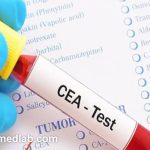 انجام آزمایش CEA در آزمایشگاه فارابی