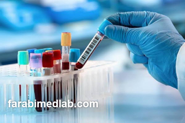 شرایط انجام آزمایش کورتیزول