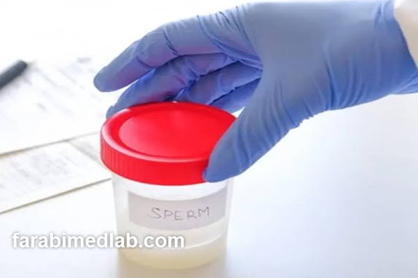 شرایط مناسب برای نمونه گیری اسپرم