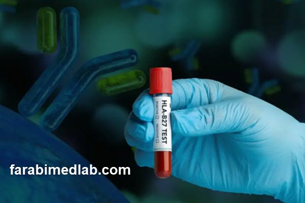 performing-the-hla-b27-test-at-farabi-laboratory-farabimedlab.com انجام تست HLA B27 در آزمایشگاه فارابی