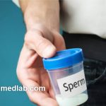 بهترین زمان برای آزمایش اسپرم