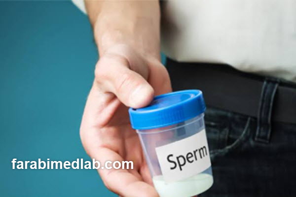 the-best-time-for-a-sperm-test-farabimedlab.com بهترین زمان برای آزمایش اسپرم