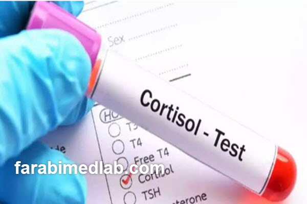 what-is-a-cortisol-test-and-when-is-it-performed-farabimedlab.com آزمایش کورتیزول چیست و چه زمانی انجام میشود؟