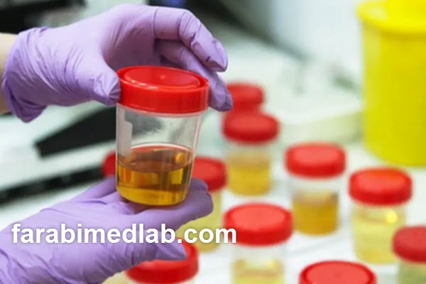 performing-a-urine-metanephrine-test-in-north-tehran-farabimedlab.com انجام تست متانفرین ادرار در شمال تهران