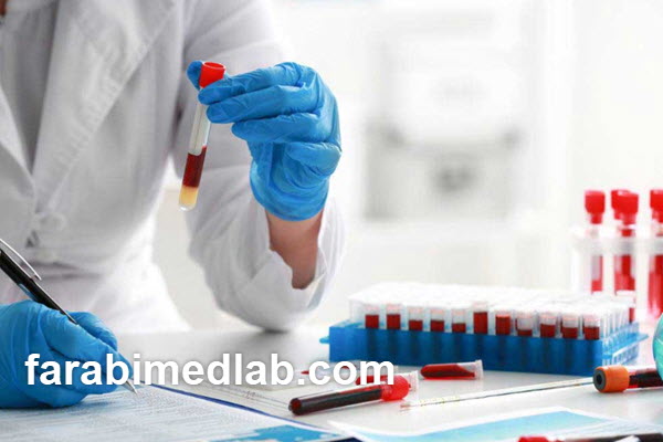 what-is-free-kappa-in-a-blood-test Free kappa در آزمایش خون چیست؟