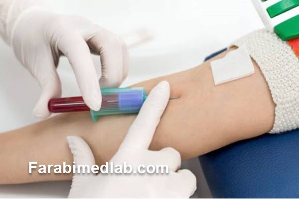 آزمایش هورمونی چیست و چه کاربردی دارد؟
