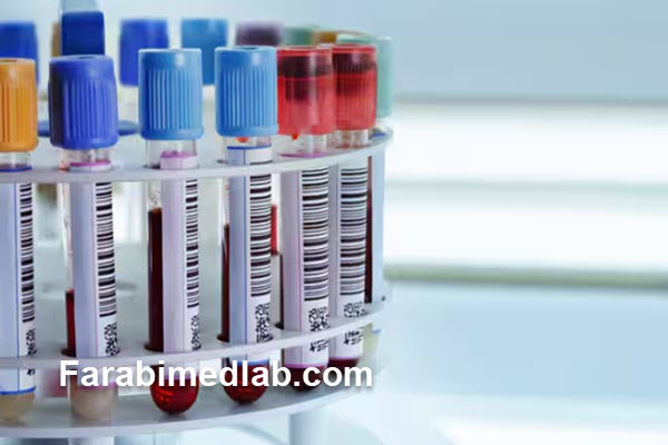 آیا آزمایش CRP و ESR به ناشتایی نیاز دارند؟