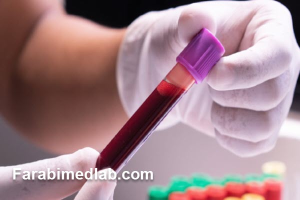 بررسی-تفاوت-آزمایش-آهن،-فریتین-و-TIBC بررسی تفاوت آزمایش آهن، فریتین و TIBC