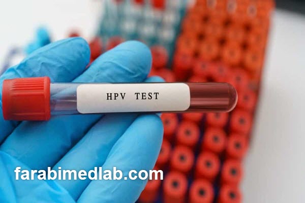 هزینه-تست-HPV-با روش-مولکولی-چقدر-است؟-شاخص هزینه تست HPV با روش مولکولی چقدر است؟ شاخص
